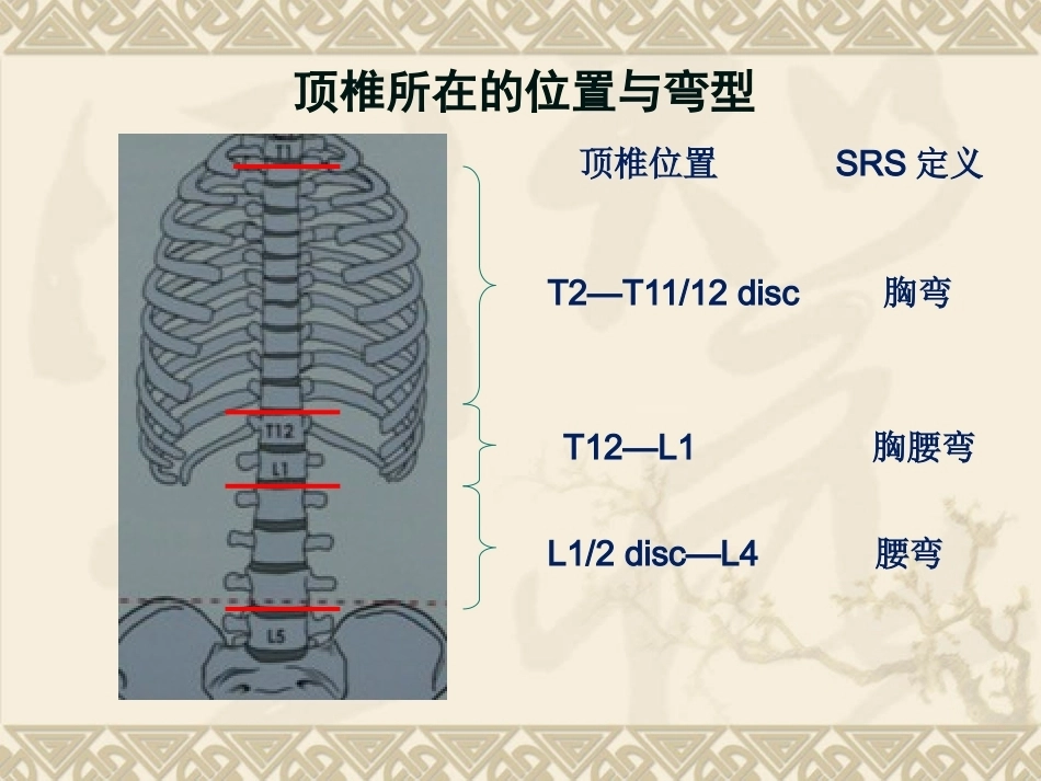 脊柱侧弯的治疗与 对策_第11页