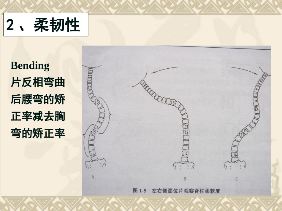 脊柱侧弯的治疗与 对策_第5页