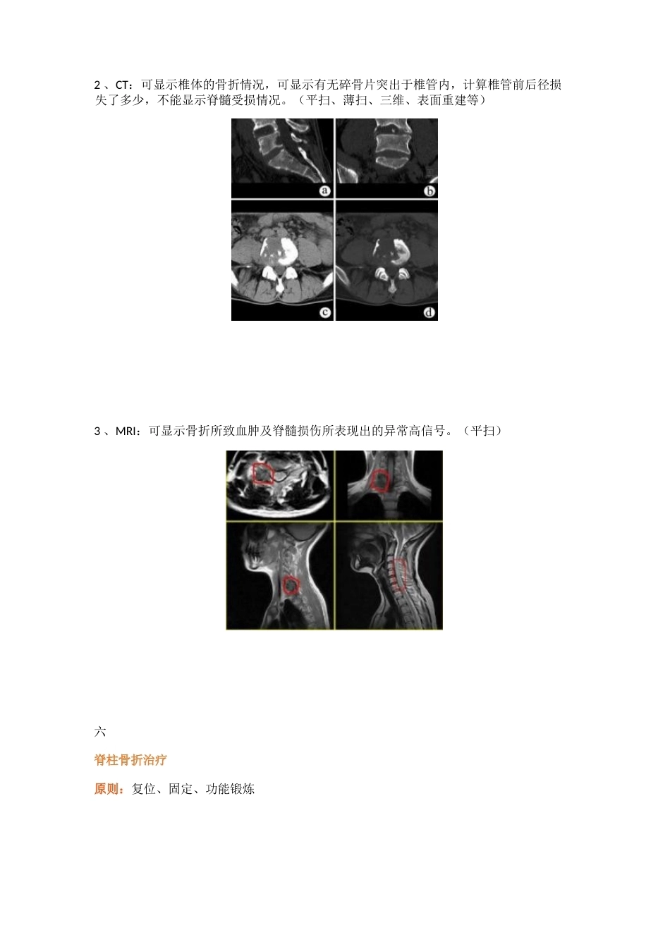 脊柱骨折的最全分类_第10页