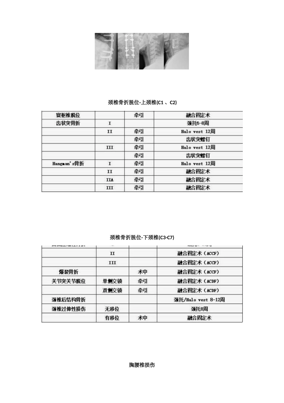 脊柱骨折的最全分类_第11页