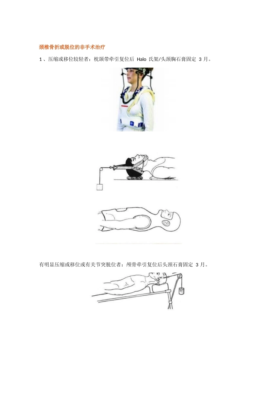 脊柱骨折的最全分类_第13页