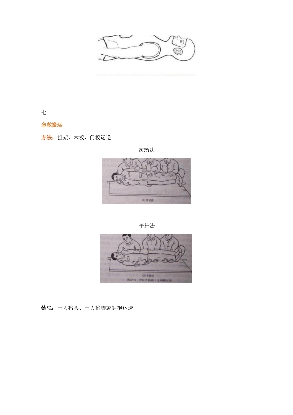 脊柱骨折的最全分类_第14页