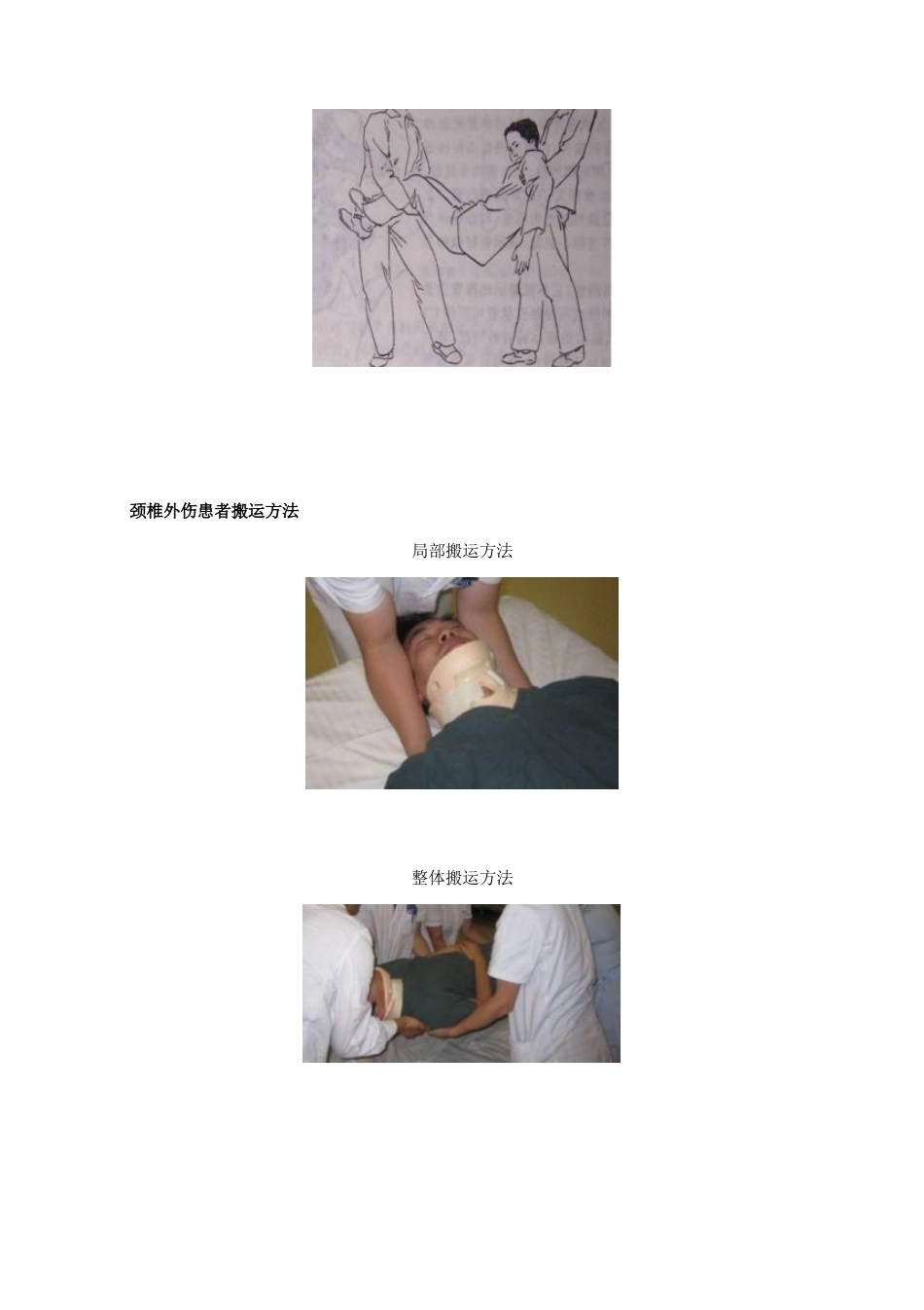 脊柱骨折的最全分类_第15页