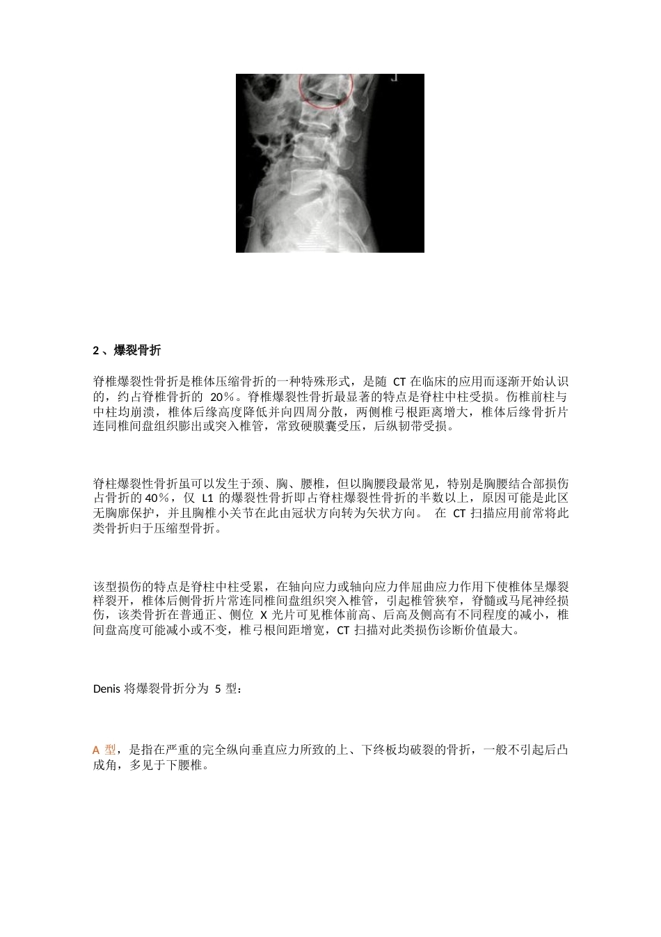 脊柱骨折的最全分类_第3页