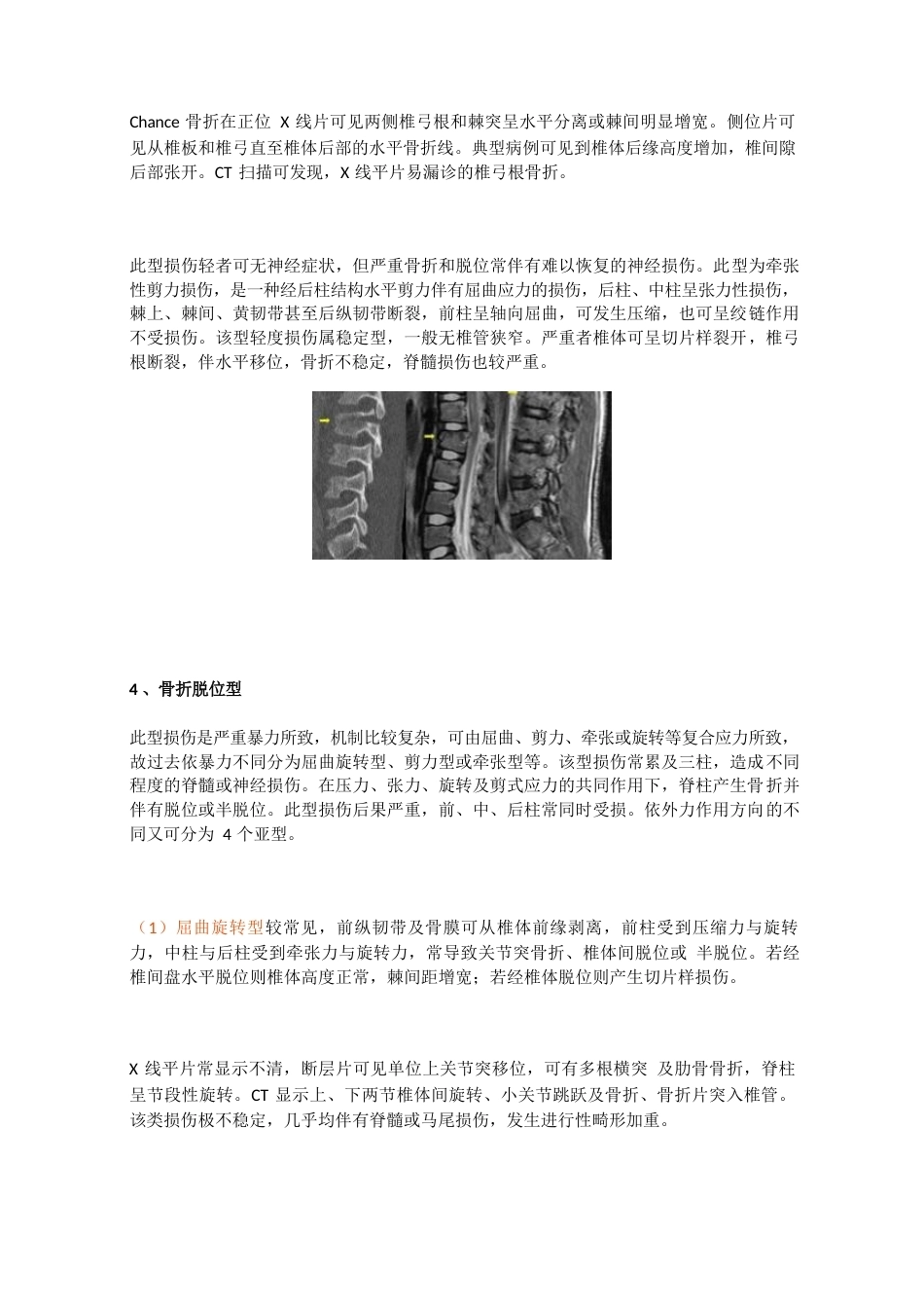 脊柱骨折的最全分类_第6页