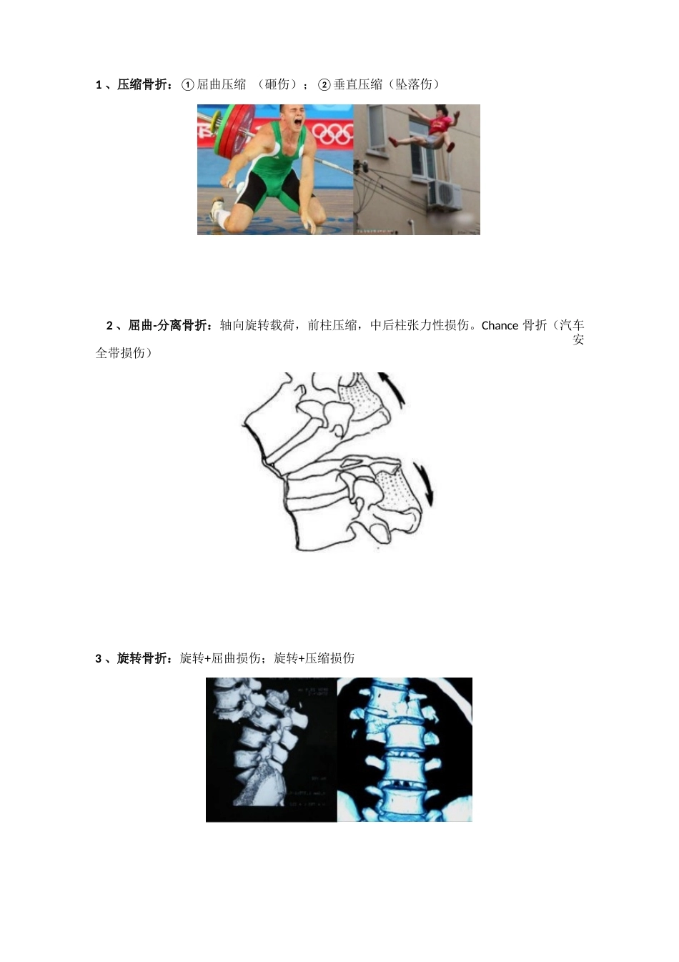 脊柱骨折的最全分类_第8页