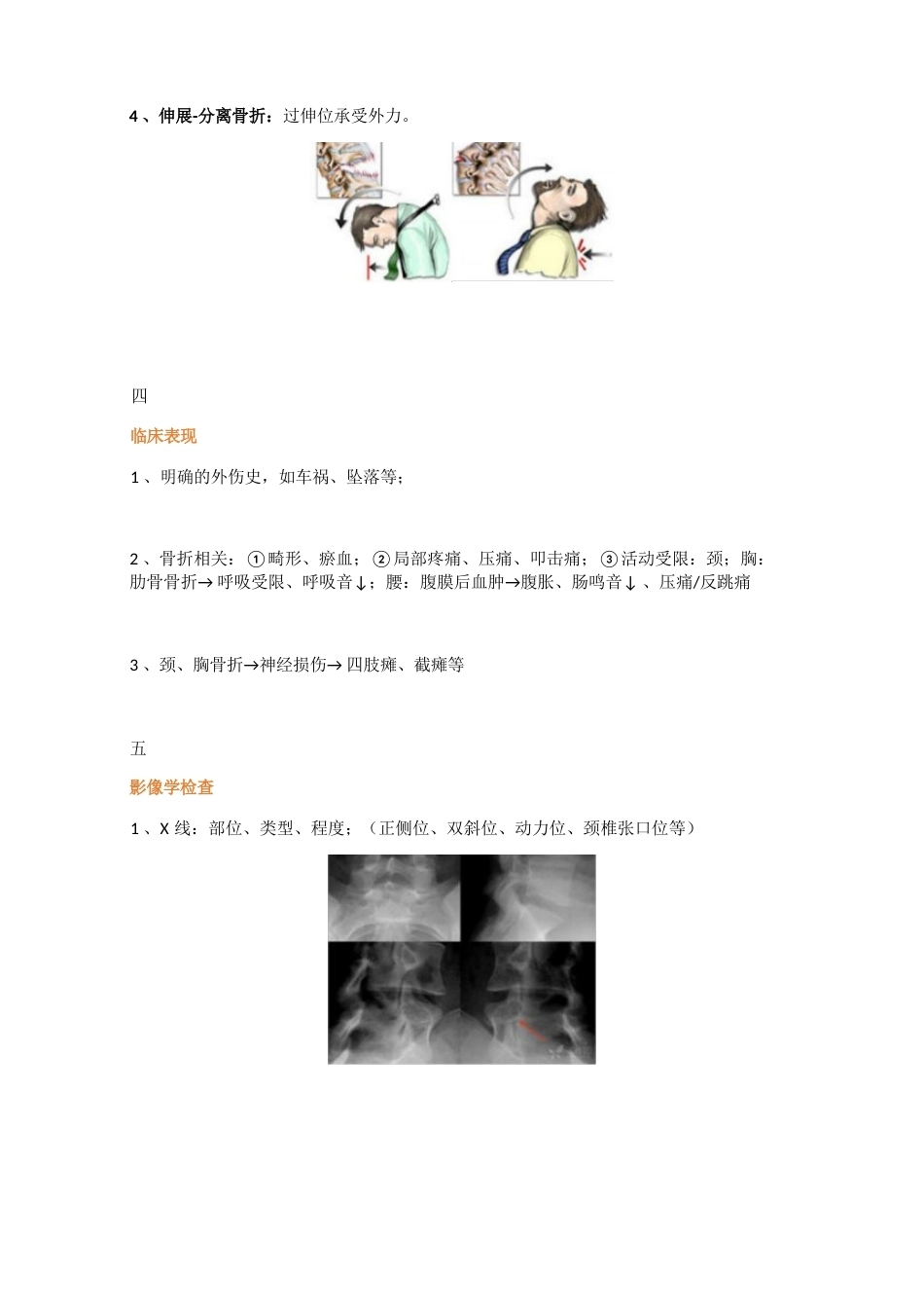 脊柱骨折的最全分类_第9页