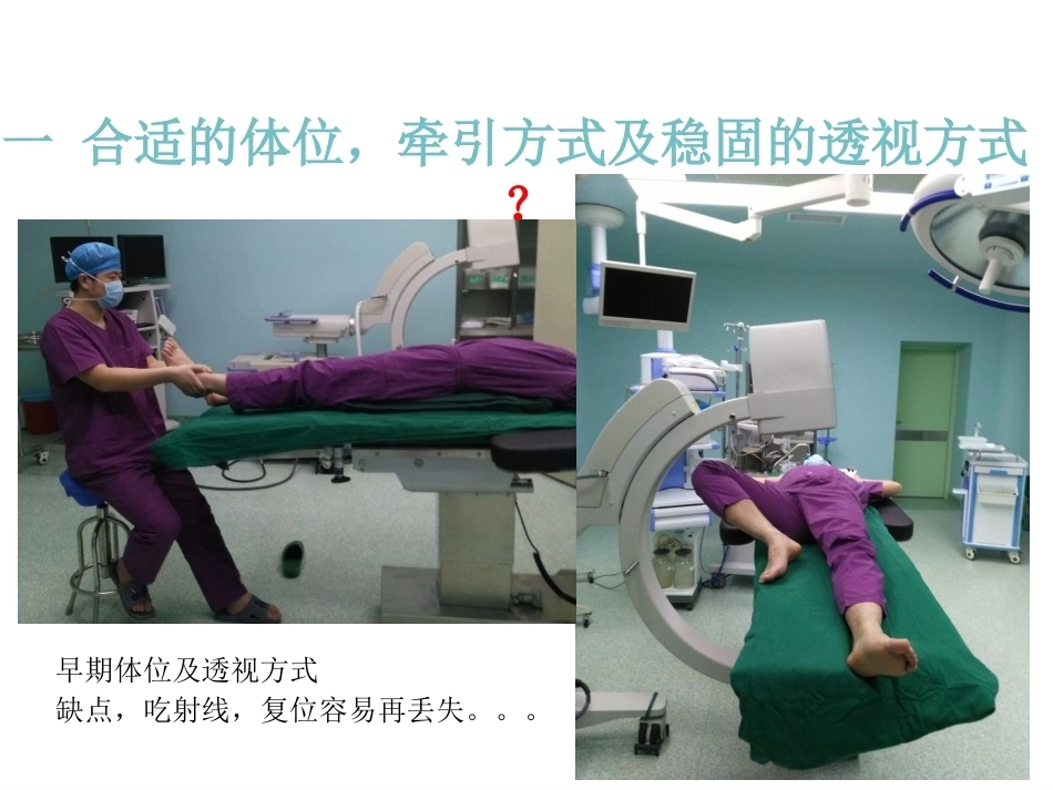 股骨近端骨折的几个感悟_第2页