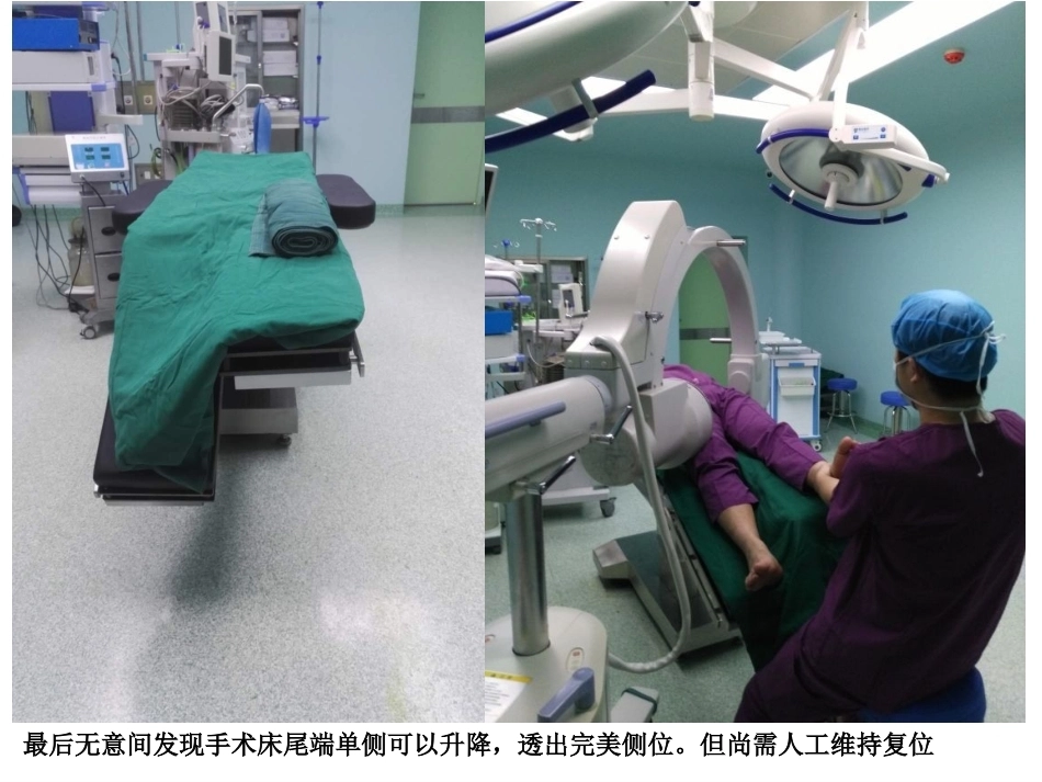 股骨近端骨折的几个感悟_第4页