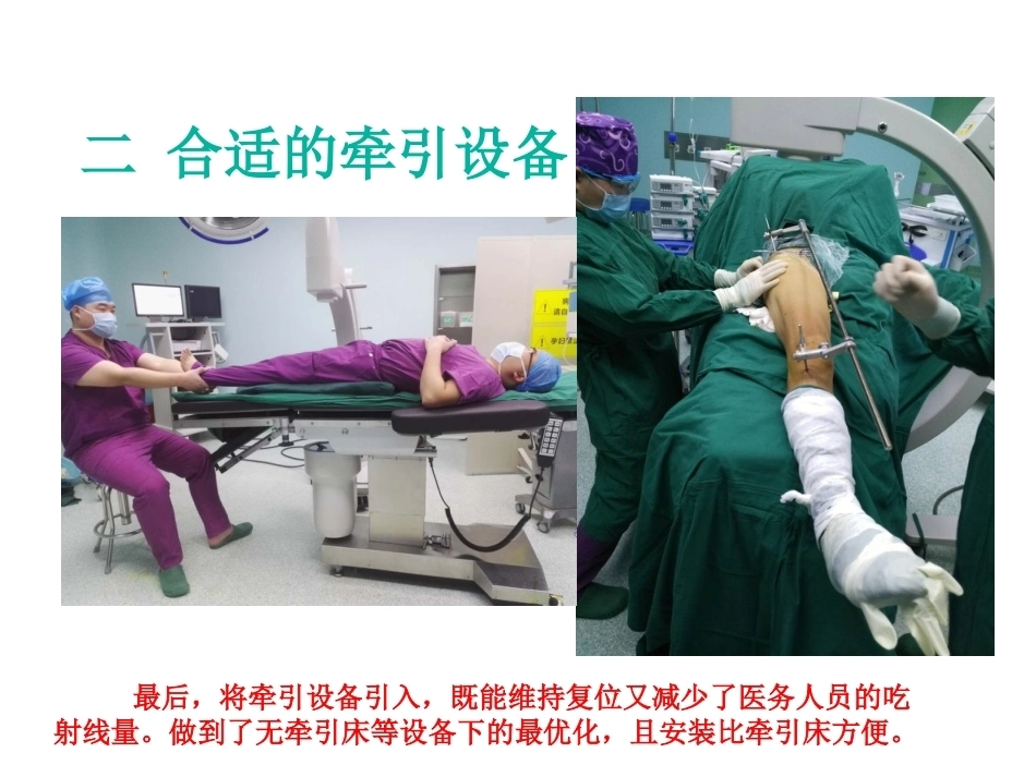 股骨近端骨折的几个感悟_第5页