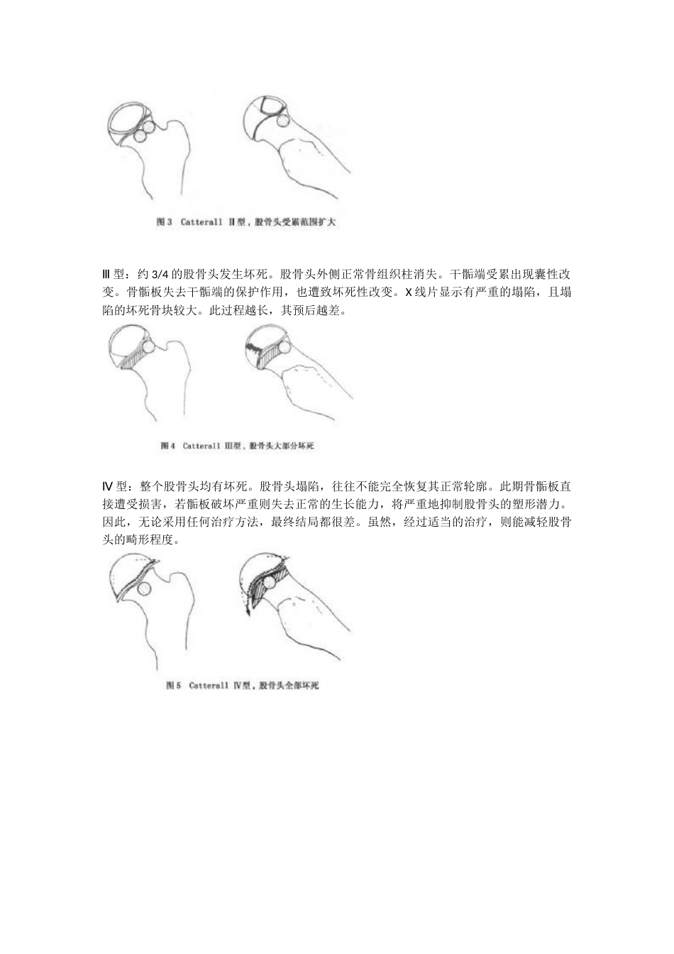 小儿骨科常见病种及分型_第15页