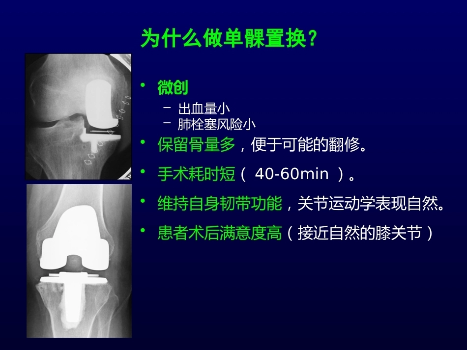 单髁置换治疗膝关节OA的复件_第15页