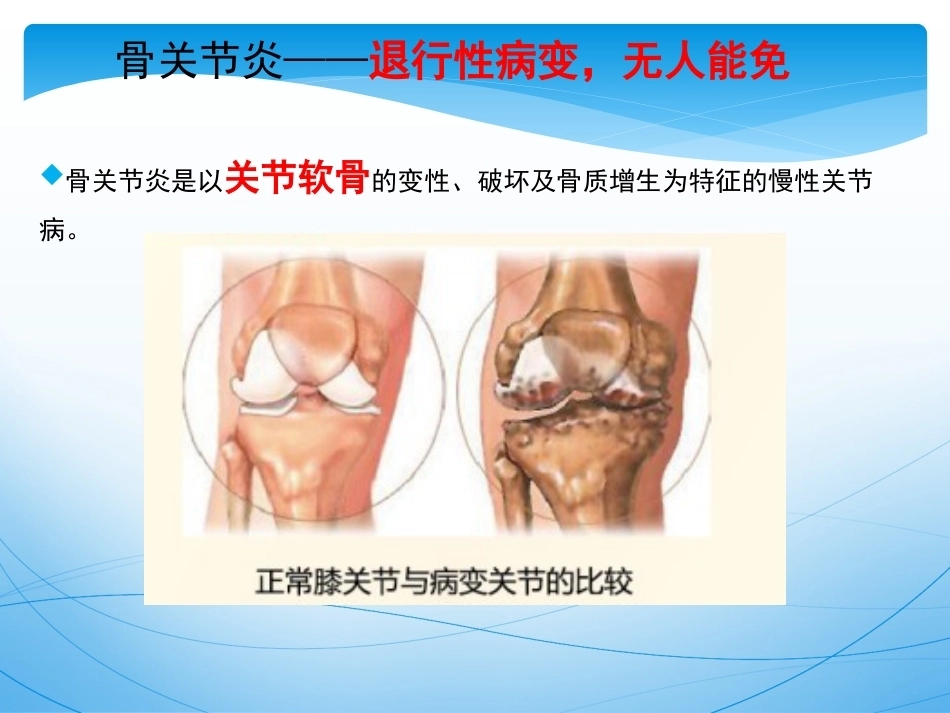 骨关节 炎的诊治_第5页