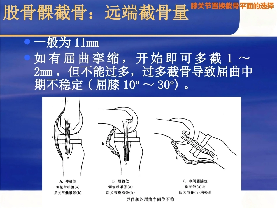 膝关节置换 截骨面的决定_第11页