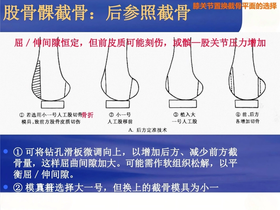 膝关节置换 截骨面的决定_第15页