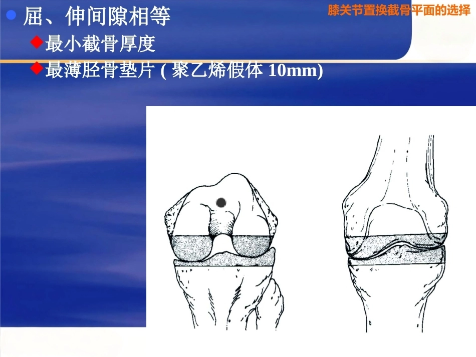 膝关节置换 截骨面的决定_第6页