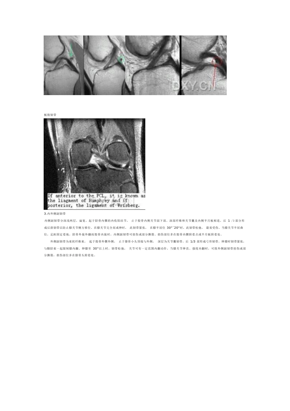 膝关节MRI诊断 之正常解剖_第11页