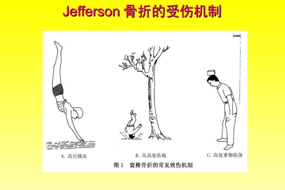 颈椎骨折分型_第7页