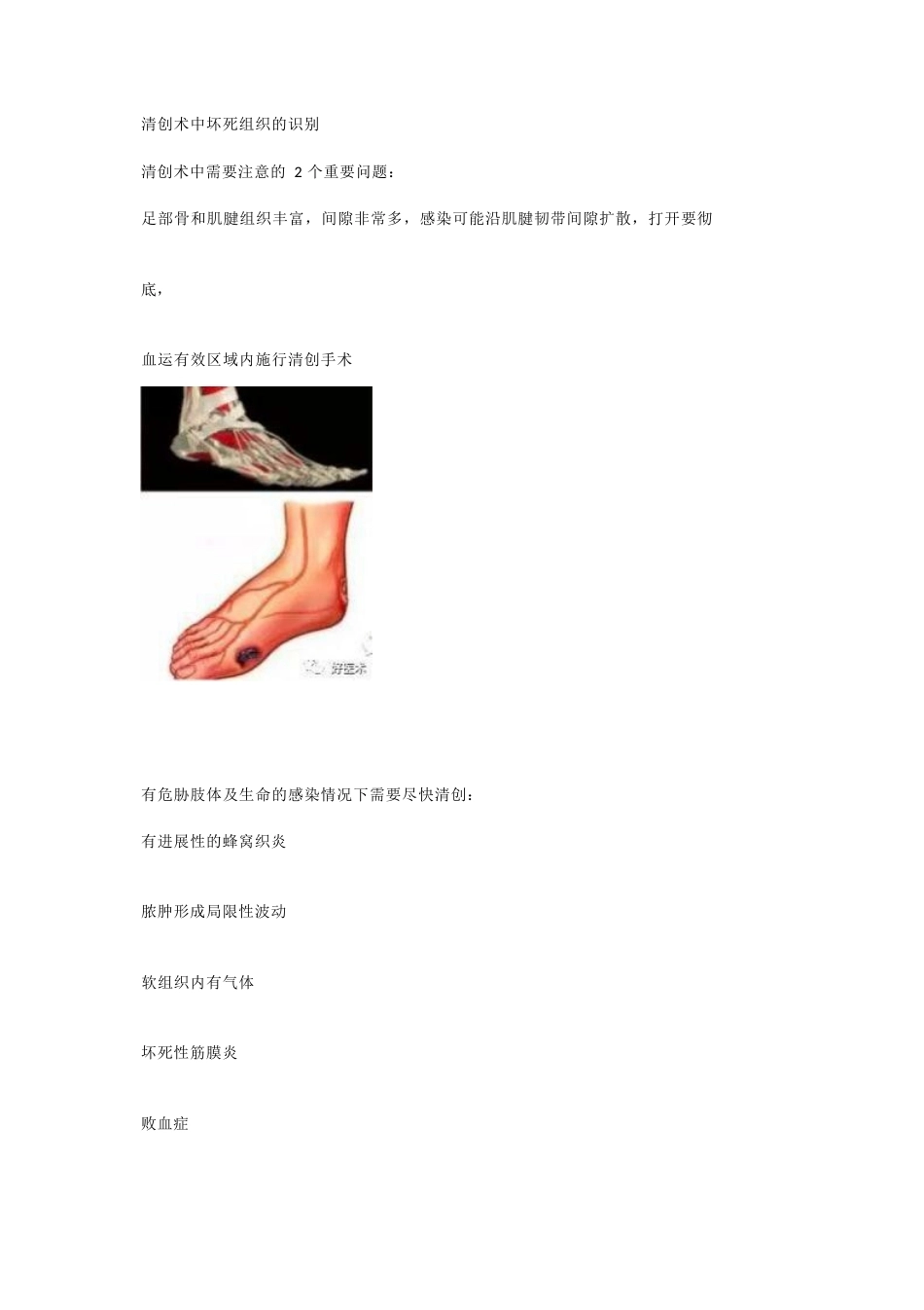 糖尿病足清创的 原则及方法_第5页