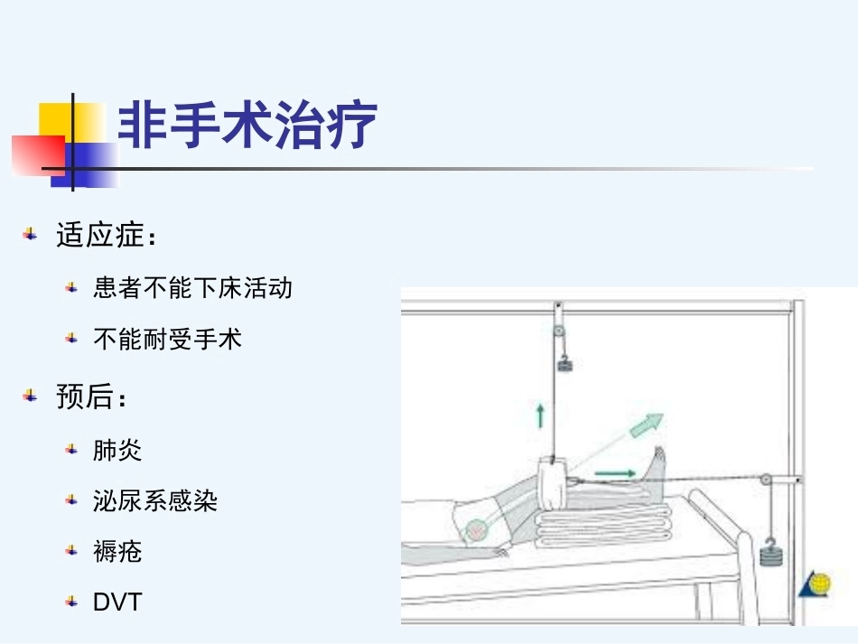 股骨粗隆 间骨折内固定_第15页