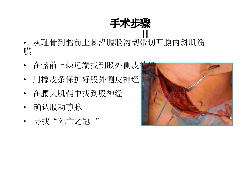 骨盆髋臼入路 选择_第10页