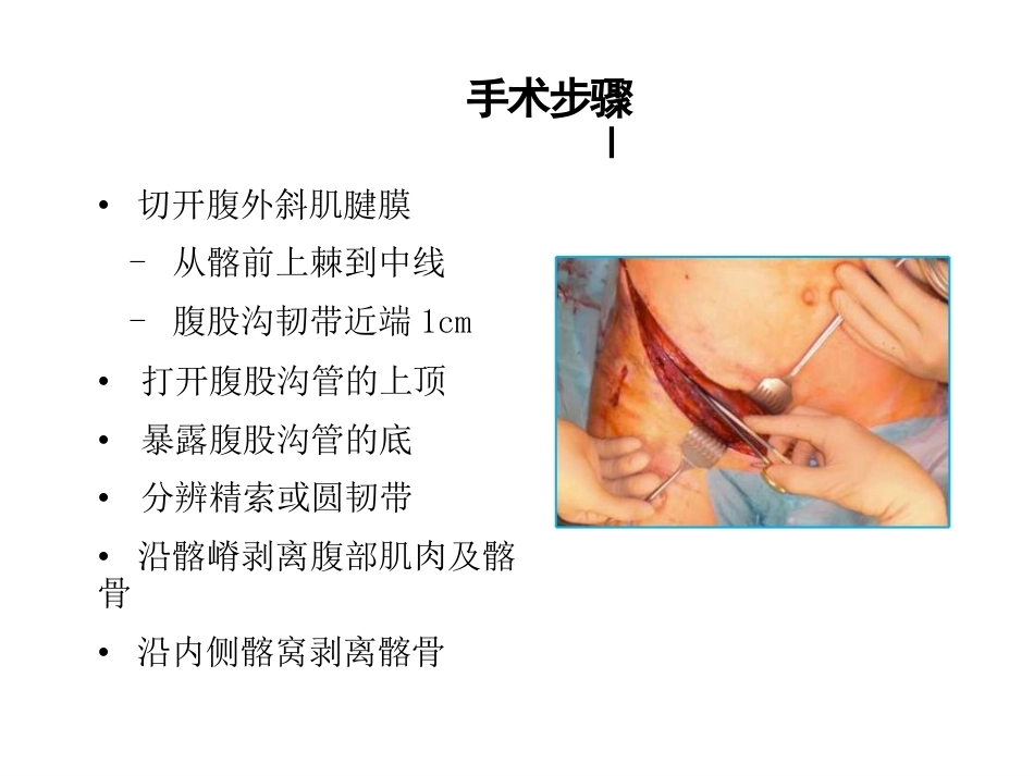 骨盆髋臼入路 选择_第9页