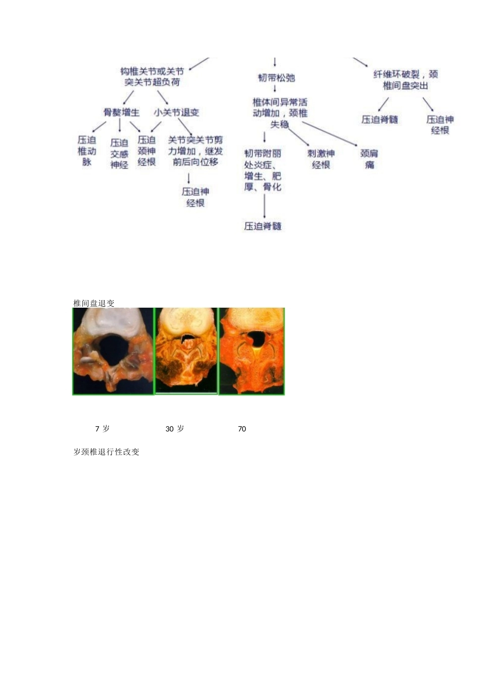 颈椎病的临床诊治 策略_第2页