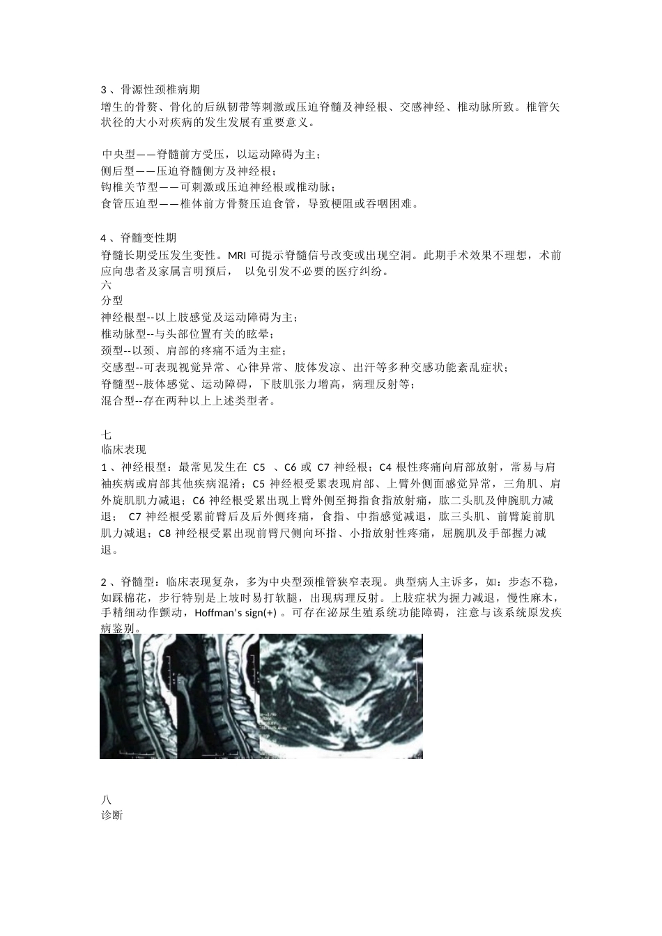 颈椎病的临床诊治 策略_第4页