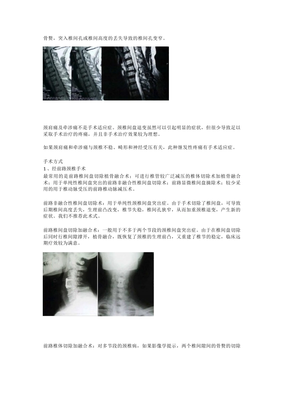 颈椎病的临床诊治 策略_第6页