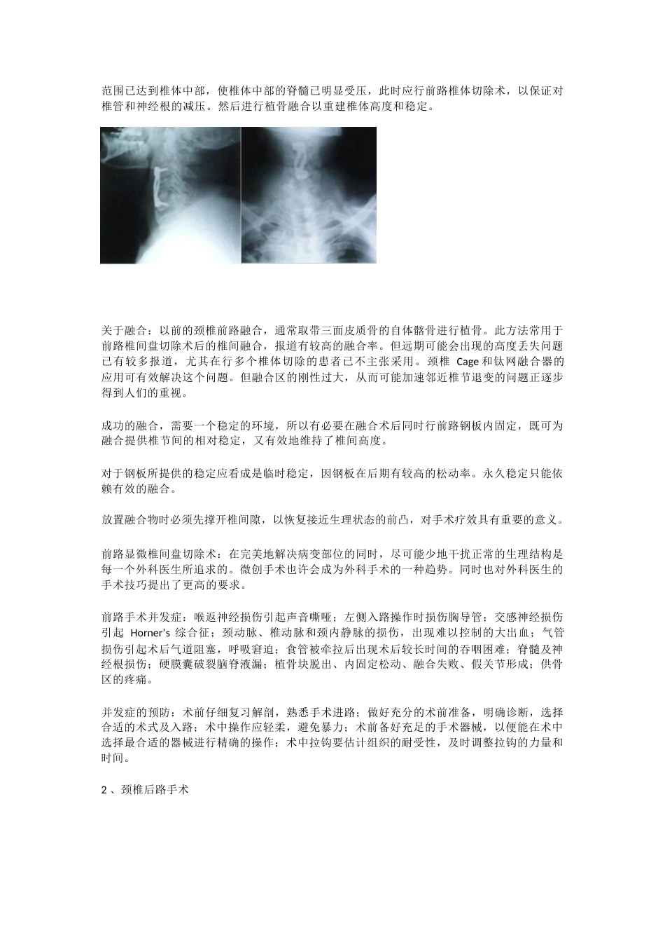 颈椎病的临床诊治 策略_第7页