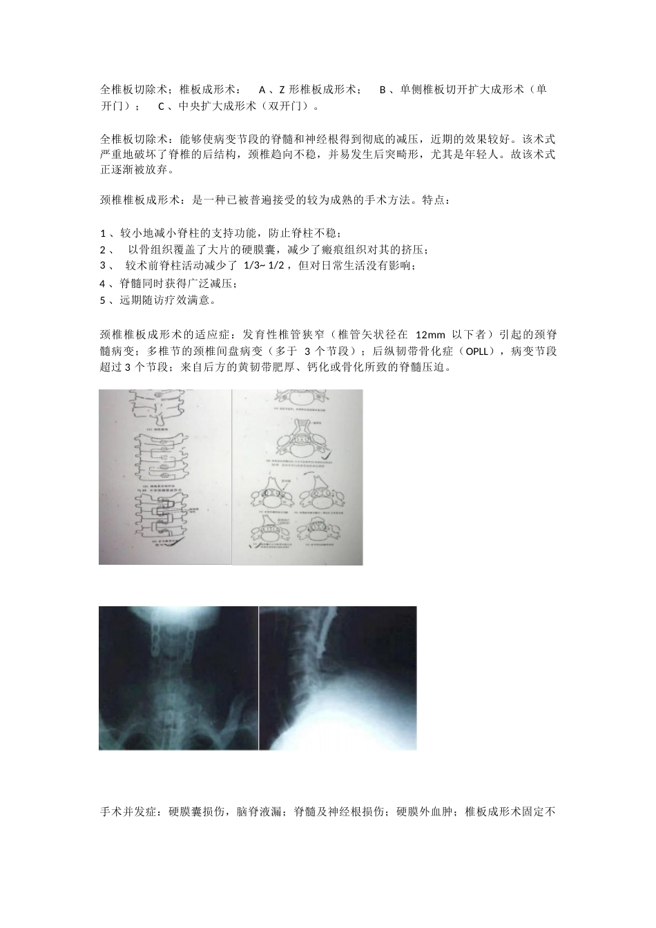 颈椎病的临床诊治 策略_第8页