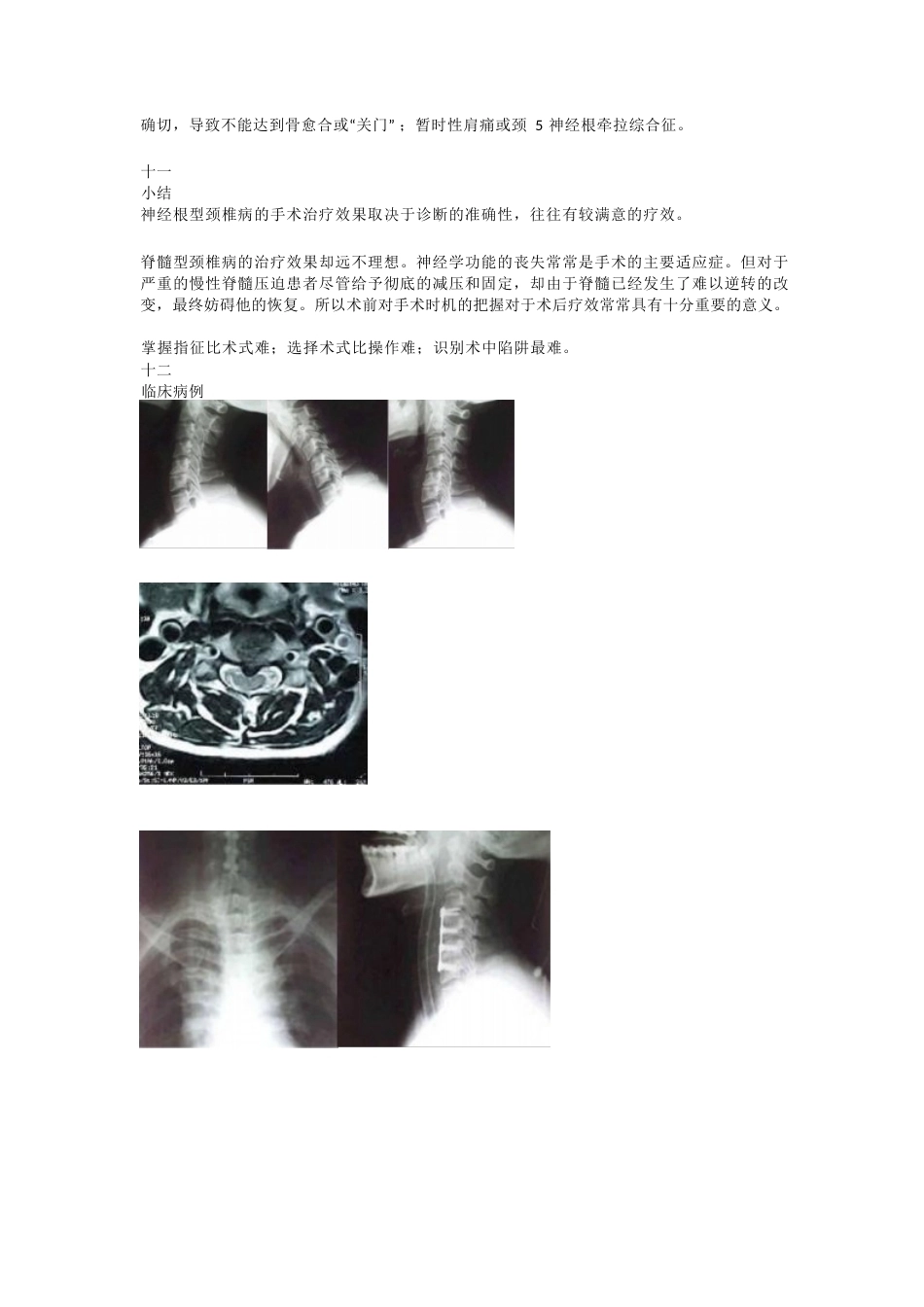 颈椎病的临床诊治 策略_第9页