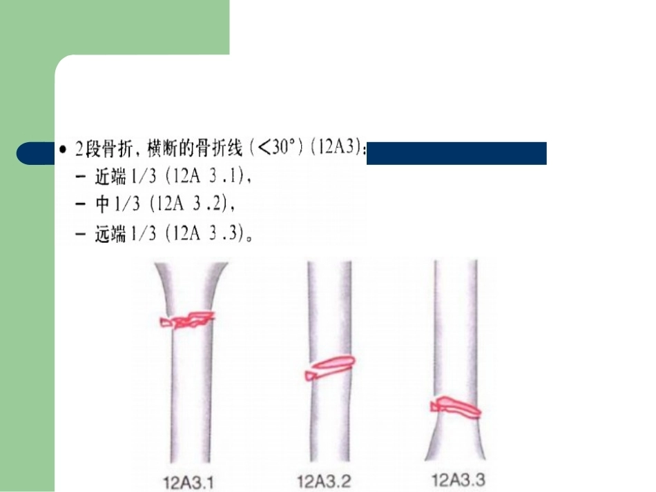 骨折分型_第10页
