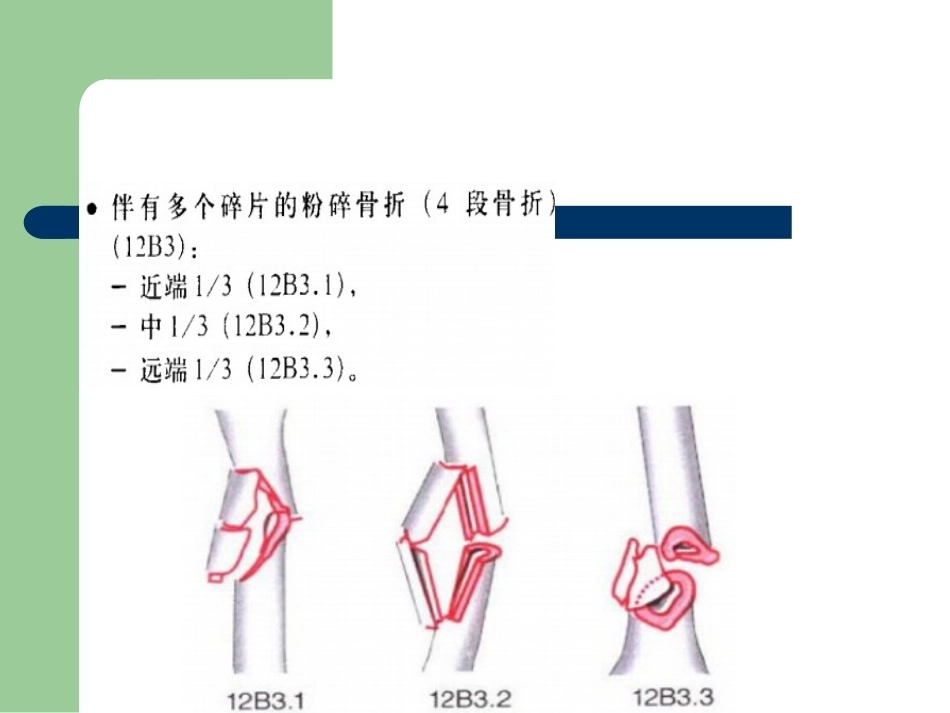 骨折分型_第13页