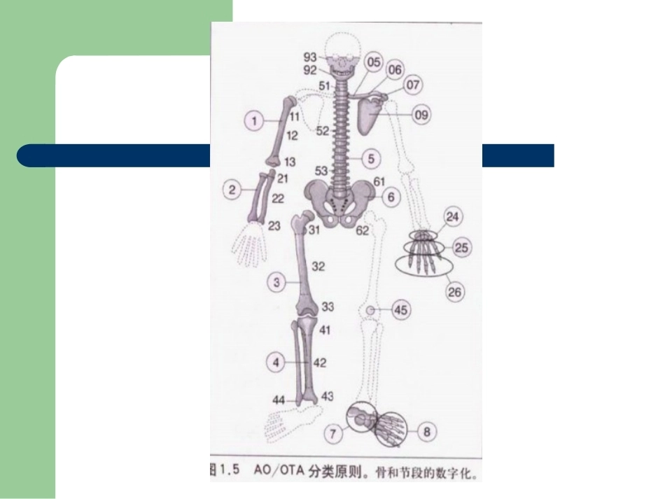 骨折分型_第5页