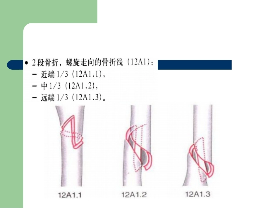 骨折分型_第8页