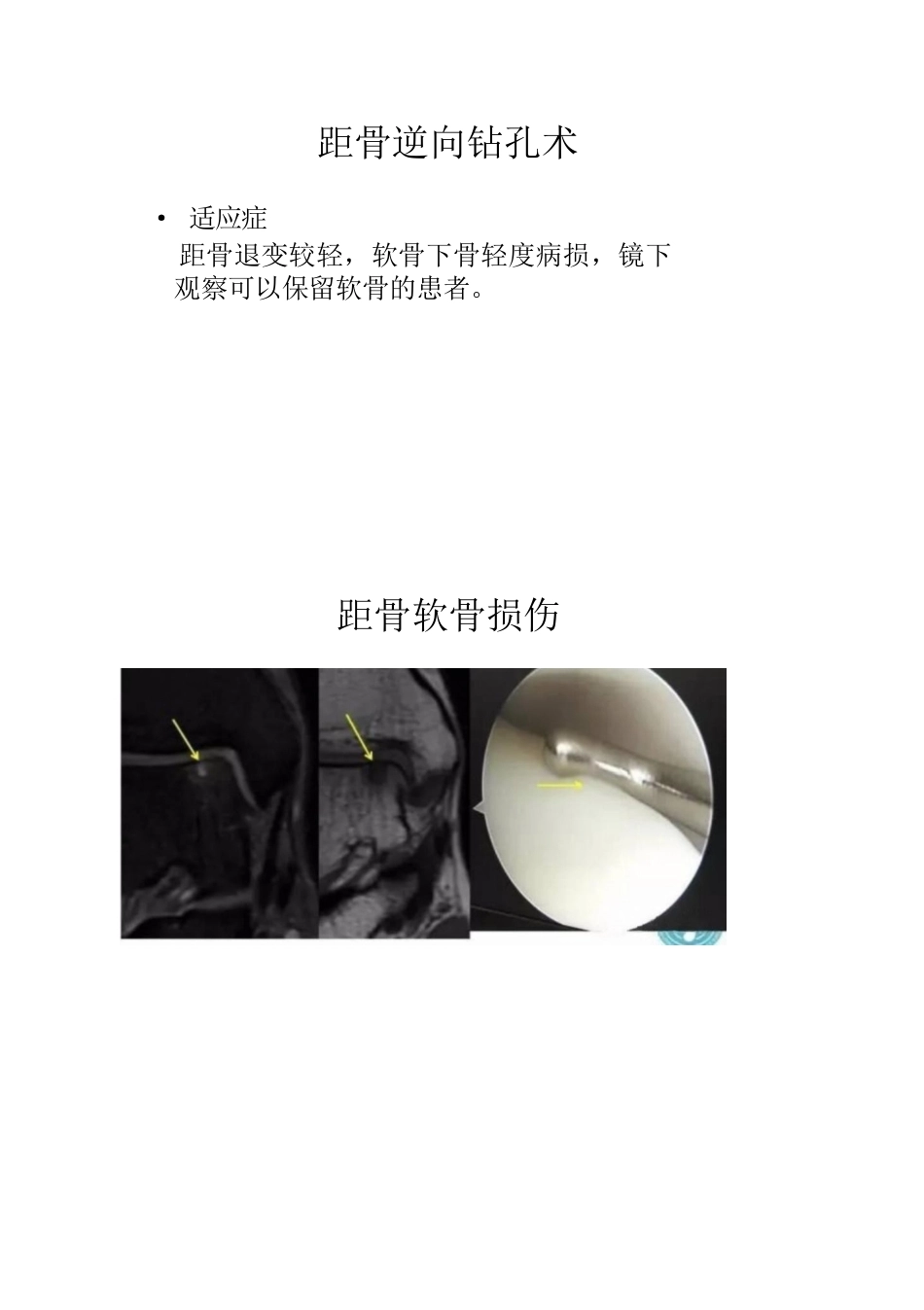距骨软骨损伤的分期及治疗_第11页