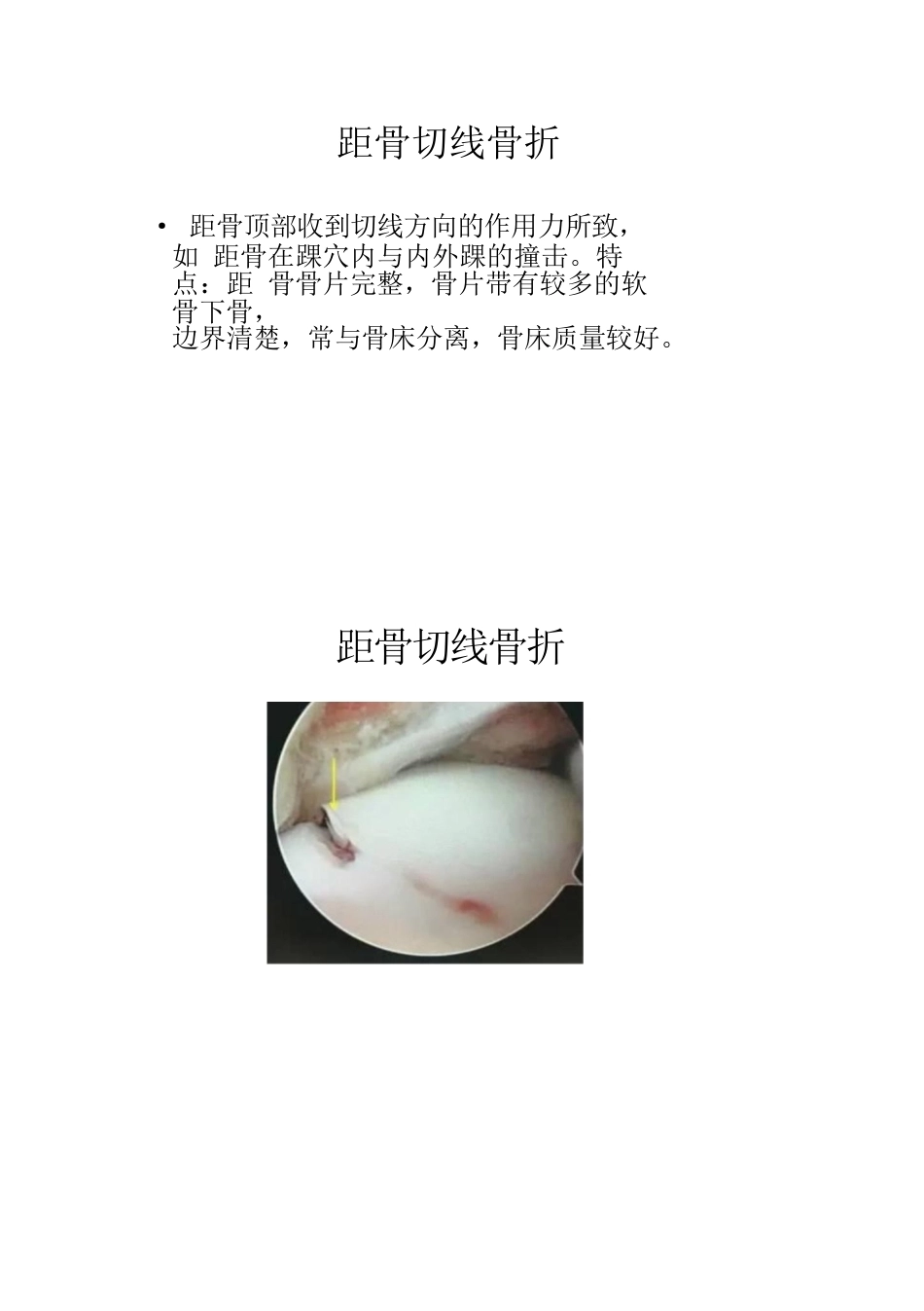 距骨软骨损伤的分期及治疗_第13页
