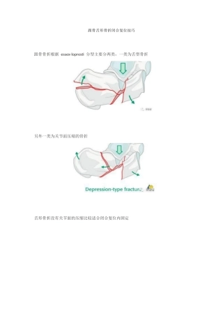 跟骨舌形骨折闭 合复位技巧