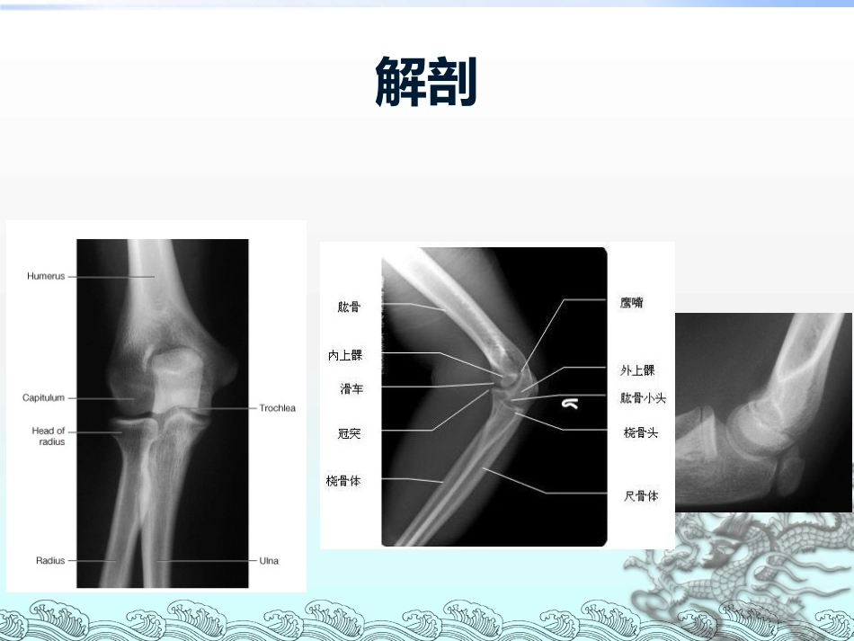 尺骨鹰嘴骨折_第6页