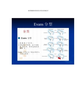 股骨粗隆间骨折的分型