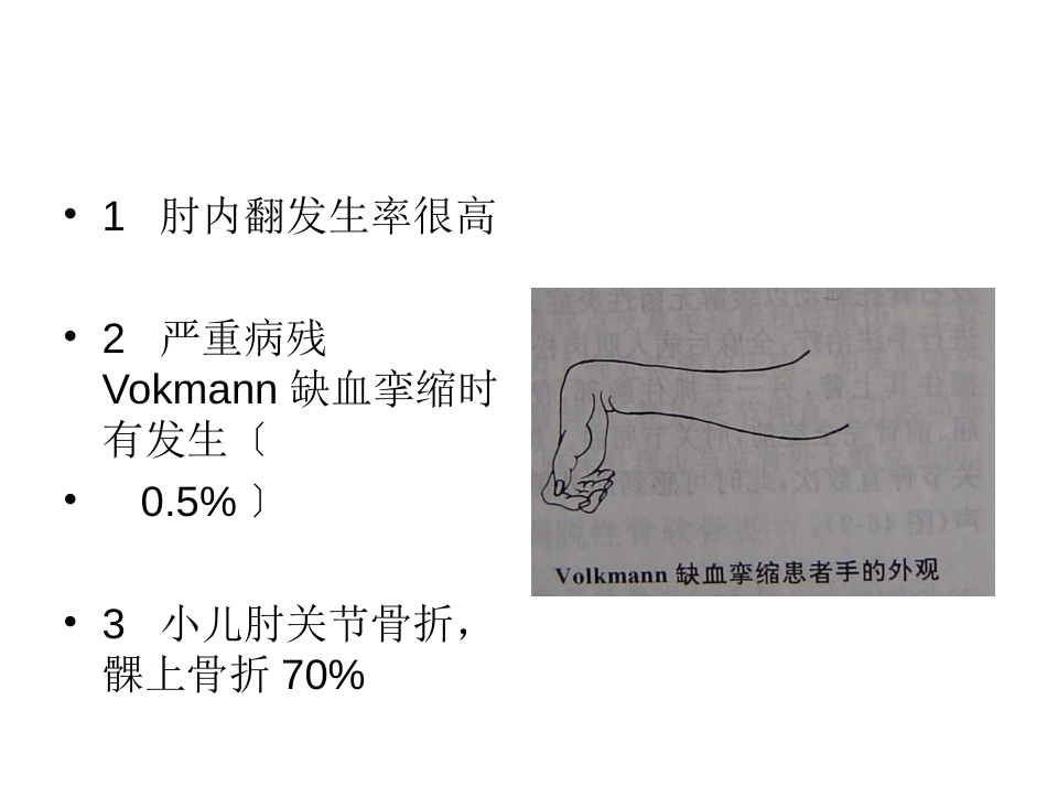 小儿肱骨髁上骨折_第4页