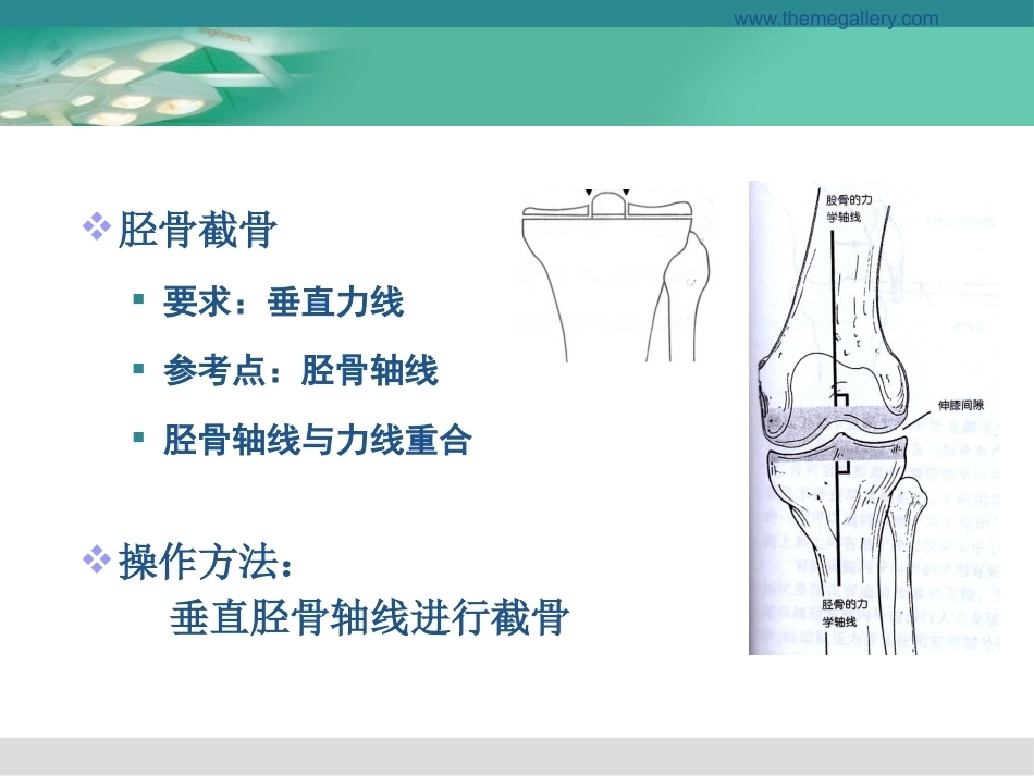 膝关节置换的手术操 作和 技巧_第11页