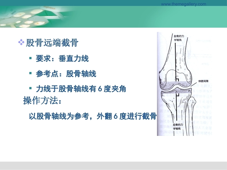 膝关节置换的手术操 作和 技巧_第13页