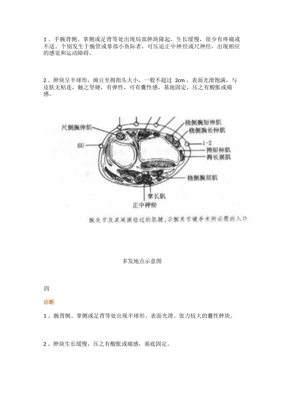 四肢腱鞘囊肿 的治疗详解_第2页