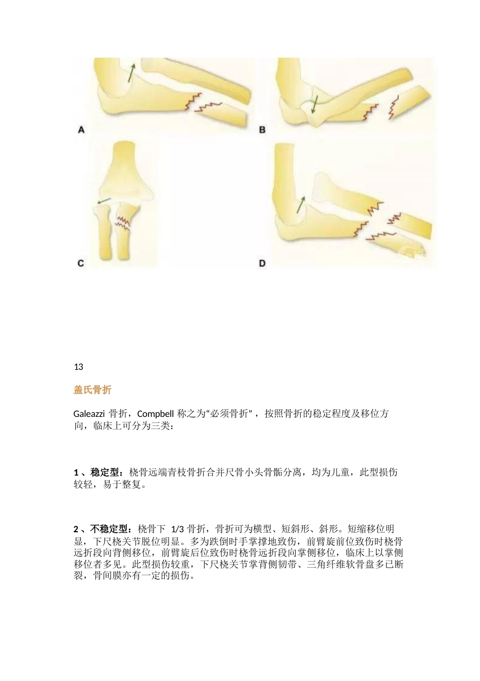 四肢骨折分型大全_第12页