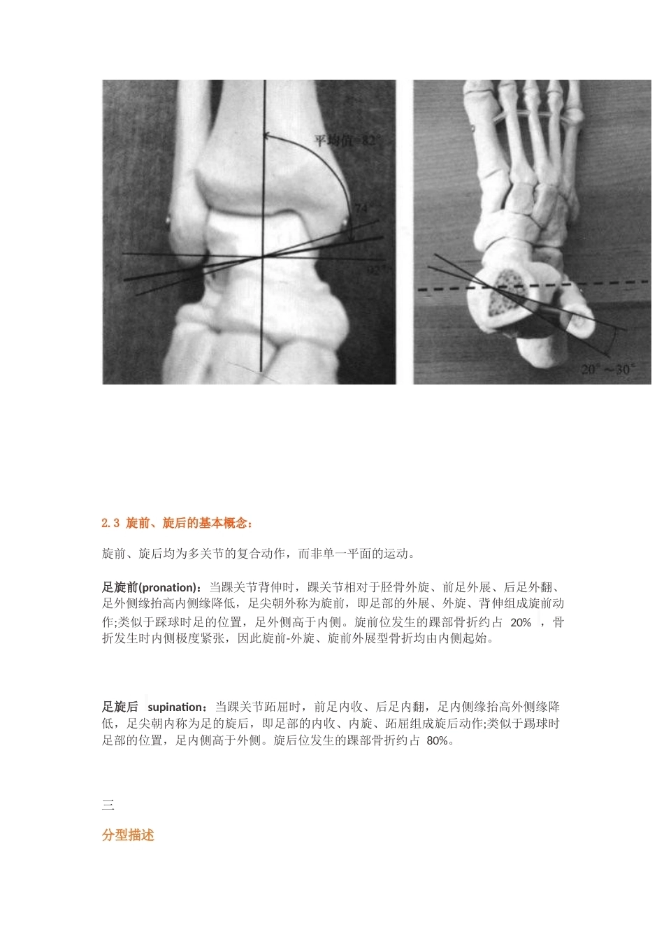 踝关节骨折的Lauge-Hansen分型_第3页