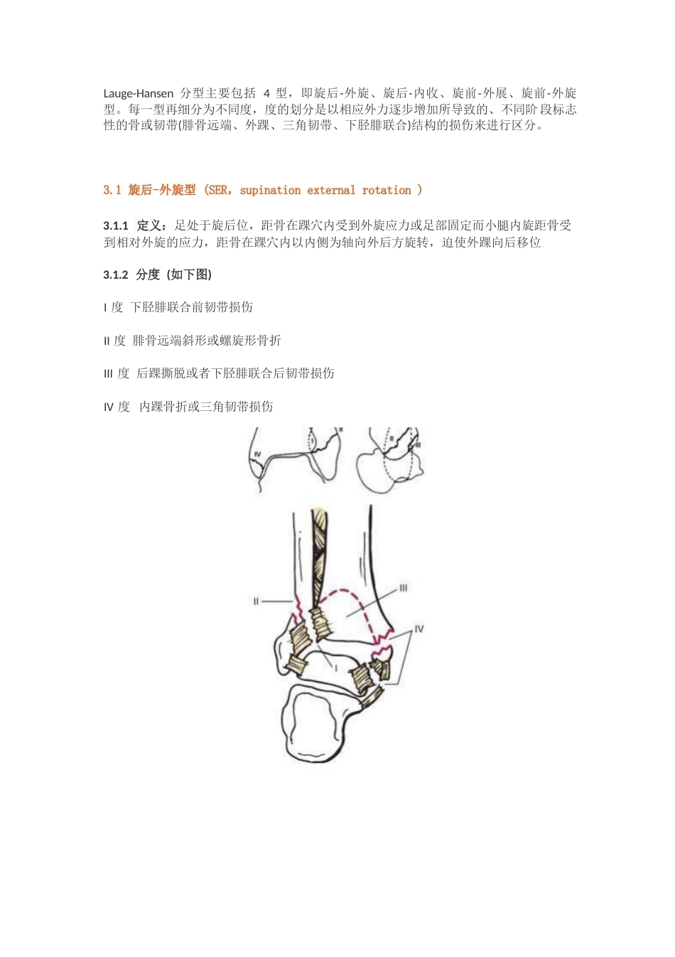踝关节骨折的Lauge-Hansen分型_第4页