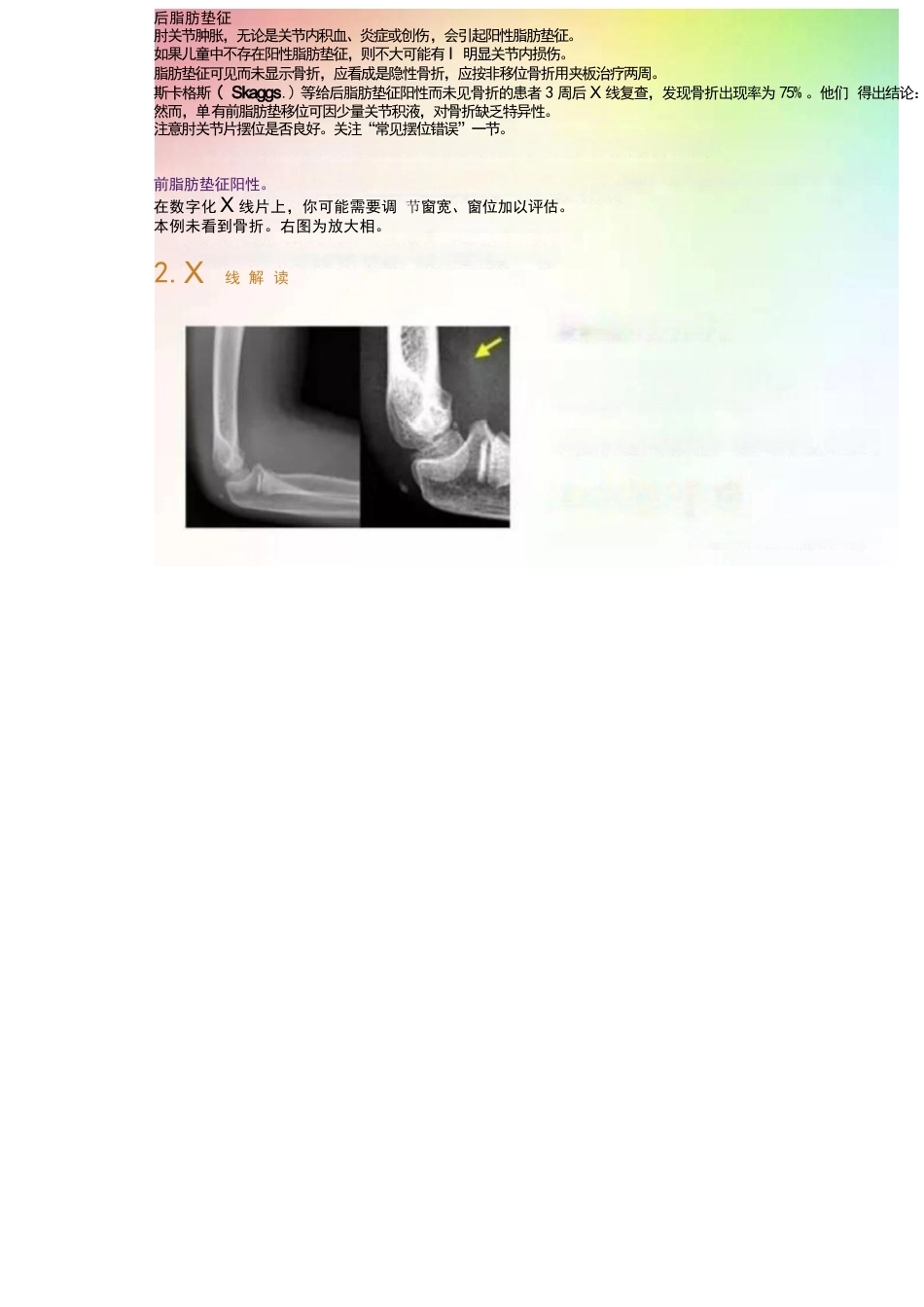 儿童肘关节骨折的分类与诊断要点_第12页