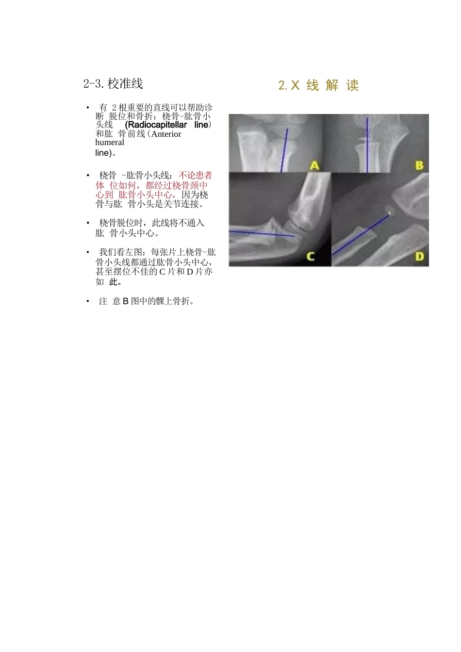 儿童肘关节骨折的分类与诊断要点_第13页